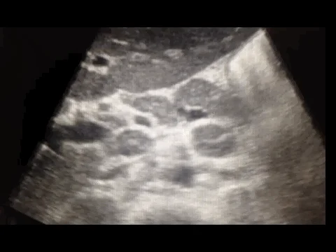 Longitudinal Mentorship in POCUS | Sept 2024 Newsletter 1 2